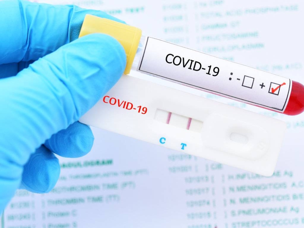 how-soon-can-you-get-reinfected-with-covid-19-sinar-daily