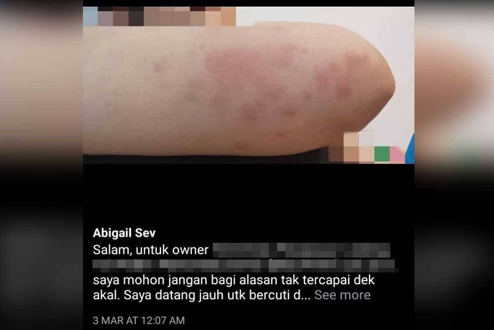 Perkongsian Abigail Sev mengenai keadaan dirinya disebabkan bilik penginapan yang tidak bersih.