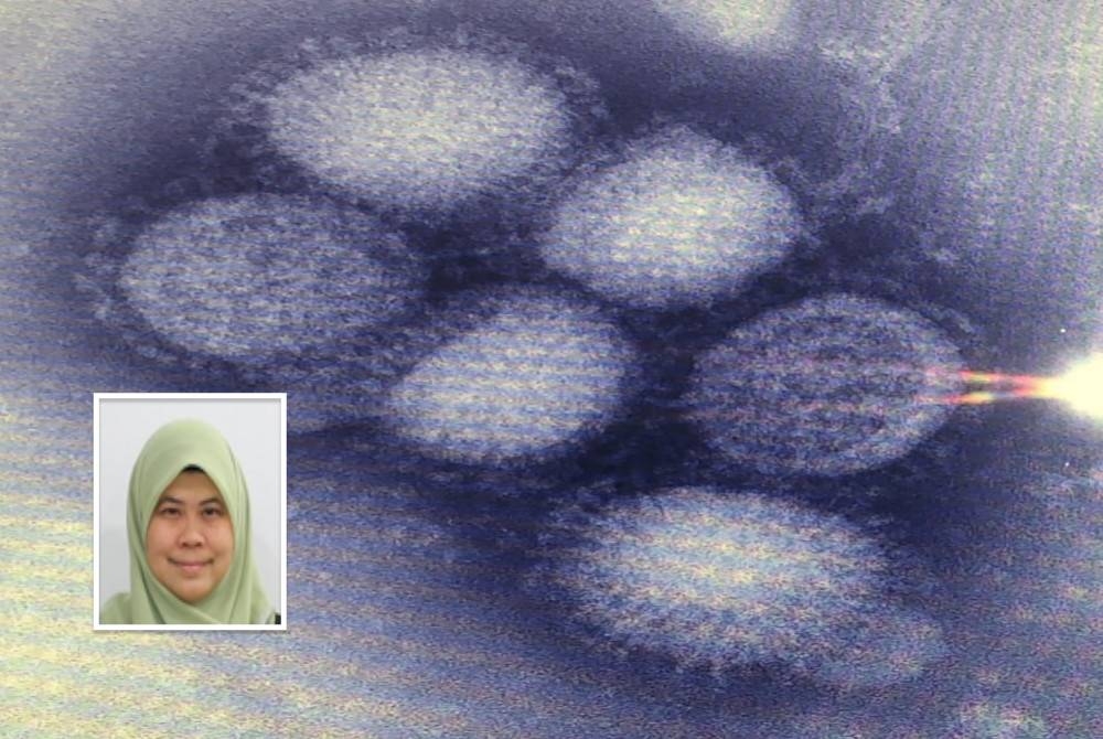 Gambaran virus influenza jenis A yang boleh menyebabkan wabak penyakit. (Gambar kecil: Dr Intan Juliana)