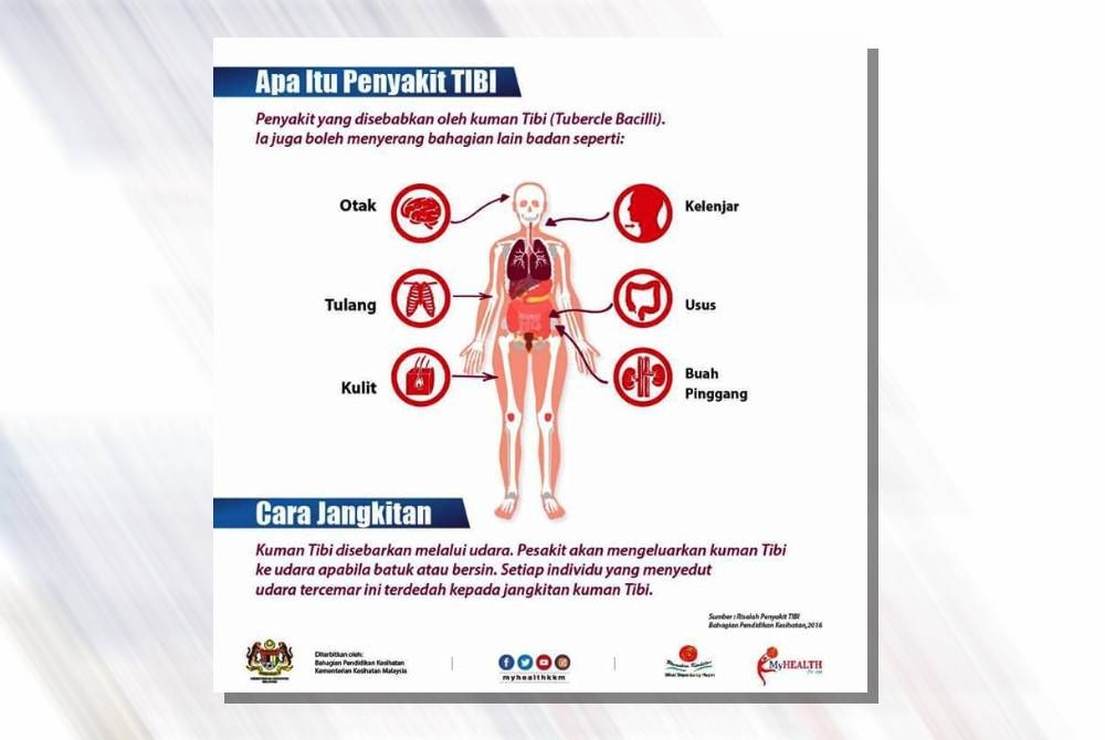 Pesakit tuberkulosis atau tibi perlu mendapatkan rawatan segera dan mengambil ubat-ubatan mengikut jadual bagi mengelak penularan wabak tersebut dalam kalangan masyarakat.