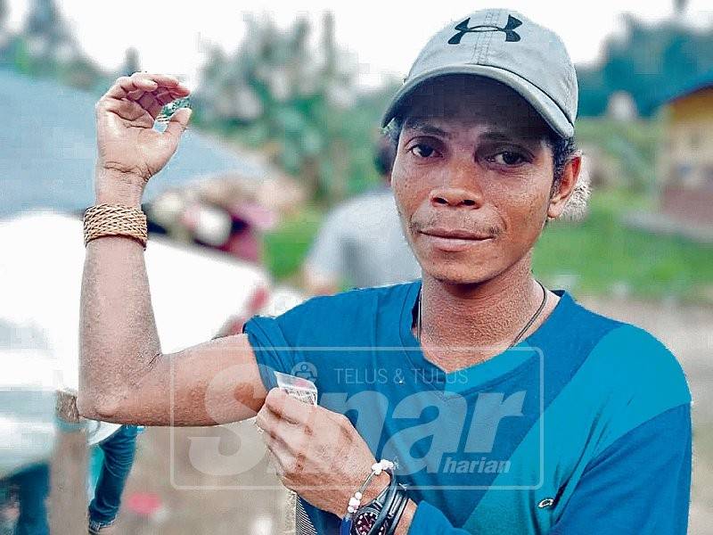 Salim menunjukkan bahagian tangannya yang kering dan bersisik.