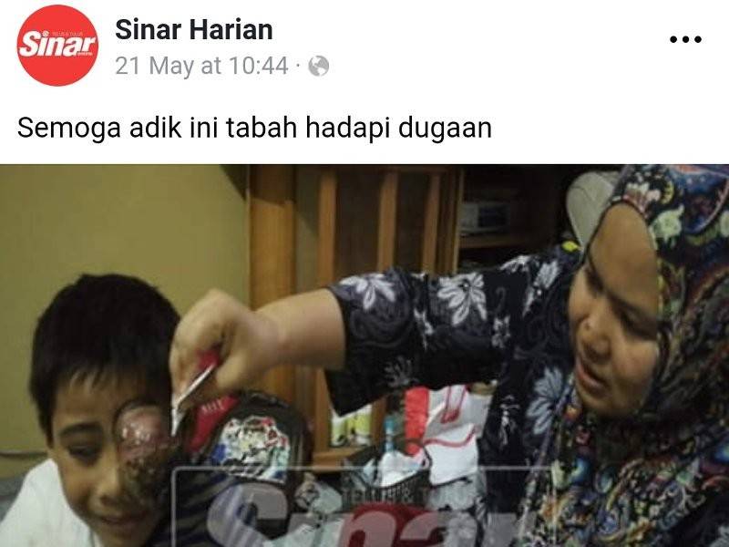 Laporan pada 21 Mei lalu memaparkan penderitaan Adam akibat kanser mata tahap empat sejak setahun lalu.