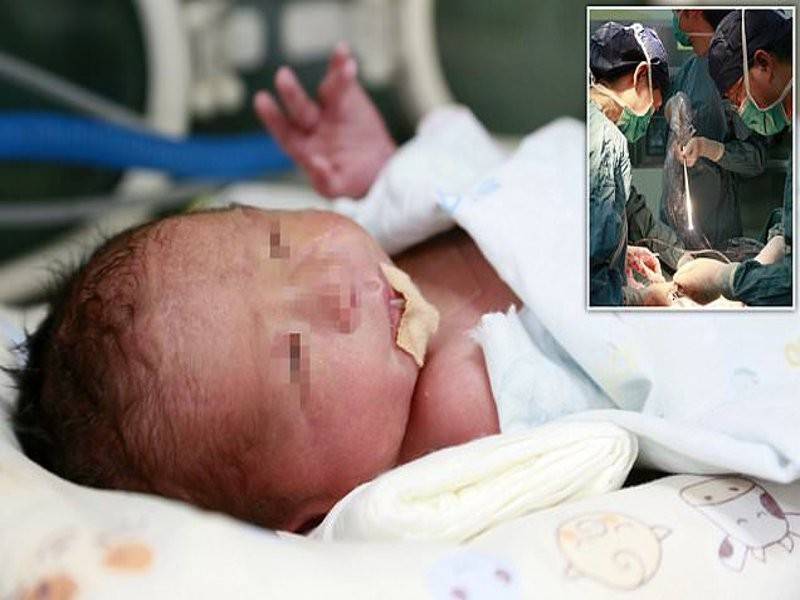 Bayi seberat 2 kg itu menjadi bayi pertama di China dilahirkan melalui prosedur pemindahan rahim.
