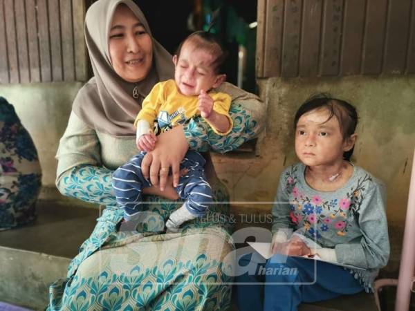 Nik Melisa bersama dua anak yang menghidap penyakit EB.