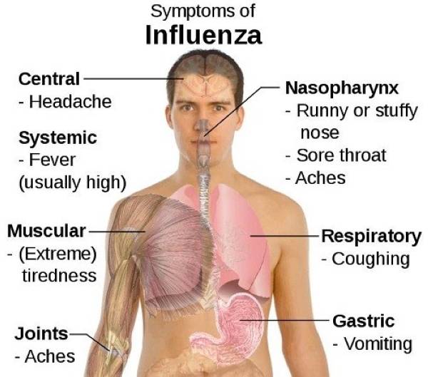 influenza