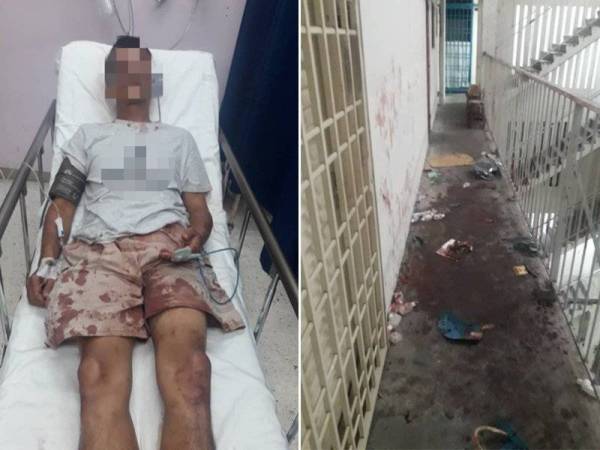 Suspek sedang dirawat di hospital dan dilaporkan tidak stabil. Gambar kanan: Tempat kejadian yang dipenuhi darah kerana berlaku tikaman menggunakan senjata tajam dalam pergaduhan tengah malam semalam.