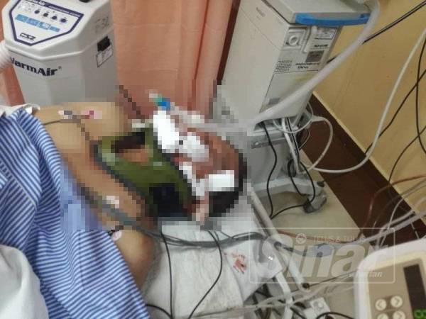 Adnan Abdullah, 52, dilaporkan kritikal dan kini dirawat di Unit Rawatan Rapi (ICU) Hospital Melaka.