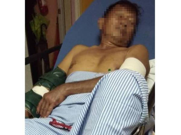 Mangsa cedera parah di tangan kanan dan luka tangan kiri serta kaki dirawat di Hospital Besut.