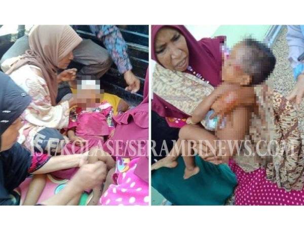 Kakak dan adik lelakinya parah dipukul bapa mereka dengan batang cangkul dalam kejadian di Aceh Timur baru-baru ini.