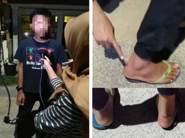 Mangsa menceritakan kejadian dia diheret lelaki bertopeng muka dan bersenjata pisau dalam kejadian di belakang Flat Hijau di Bandar Baru Kubang Kerian semalam. (Kanan: Kesan luka pada kaki mangsa dipercayai kesan pergelutan ketika diheret lelaki tidak dikenali ke dalam sebuah van putih dalam kejadian di belakang Flat Hijau di Bandar Baru Kubang Kerian Kota Bharu semalam.)
