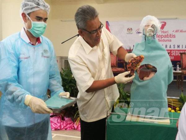 Ismail (dua dari kiri) melakukan gimik perasmian Sambutan Hari Hepatitis Sedunia 2019 peringkat Negeri Kedah yang diadakan di Kampung Nelayan Tanjung Dawai hari ini.