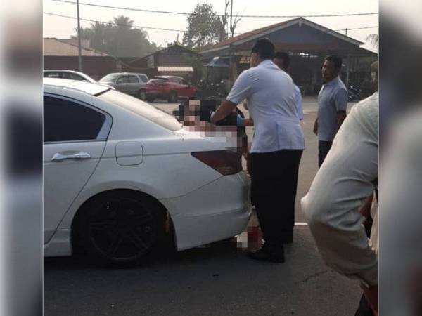 Mangsa melambung ke atas kereta selepas motosikal ditunggangi bergesel di Jalan Jelapang, Ipoh hari ini.