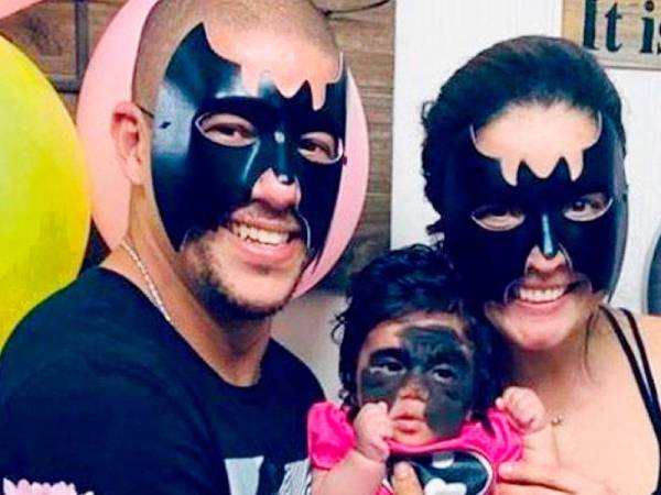 Ibu bapa Luna memakai topeng Batman sebagai tanda solidariti untuk anak mereka.