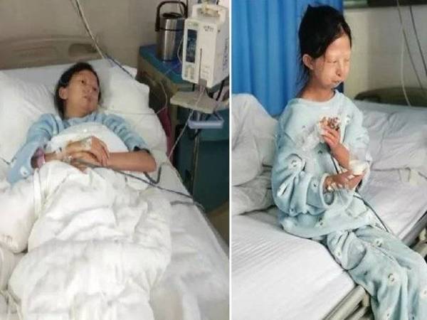 Huayuan mengalami kekurangan nutrisi yang serius hingga dikejarkan ke hospital.