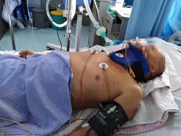 Mangsa ketika dirawat di ICU HSJ sebelum disahkan meninggal dunia pagi tadi.