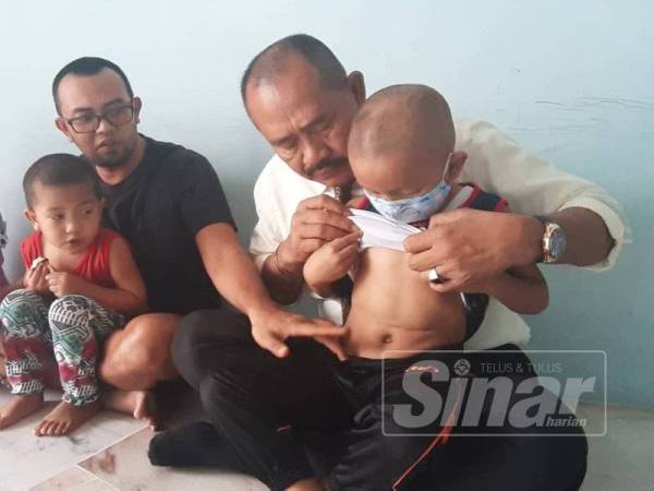 Md Roslin menunjukkan kesan pembedahan di badan Maulana kepada Abu Bakar yang membuat lawatan di rumah keluarga itu di Sungai Choh baru-baru ini.