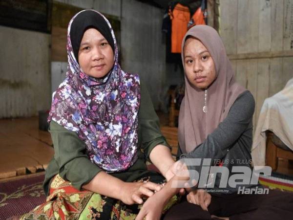 Nurul Aziemah bersama ibunya, Juliani.