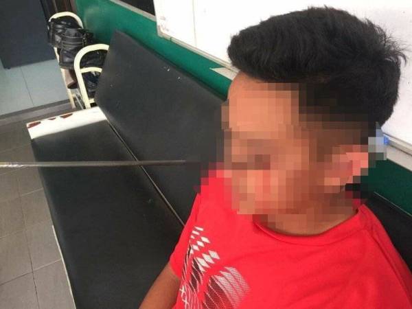 Anak panah tersasar tusuk mata kiri