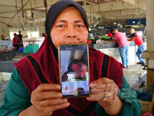 Che Minah menunjukkan gambar kepala suaminya yang berlumuran darah selepas ditetak tiga lelaki dalam kejadian samun di Kampung Air Tawar, Tok Bali malam tadi 