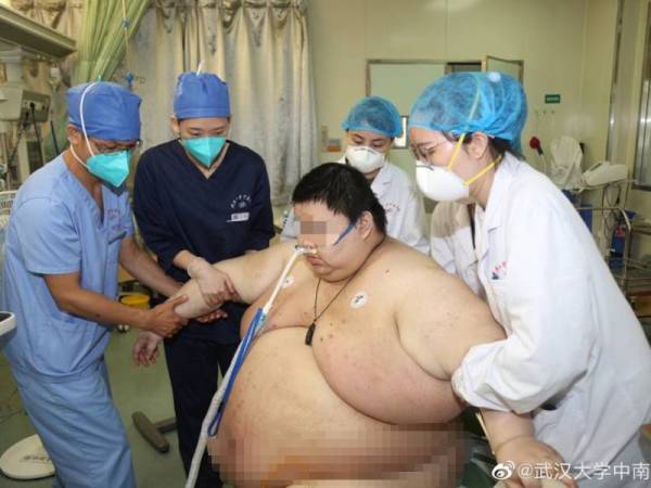 Zhou menerima rawatan bagi mengurangkan berat badannya di sebuah hospital di Wuhan. - Foto Odditycentral