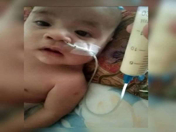 Muhammad Aisy menggunakan tiub untuk minum susu. 