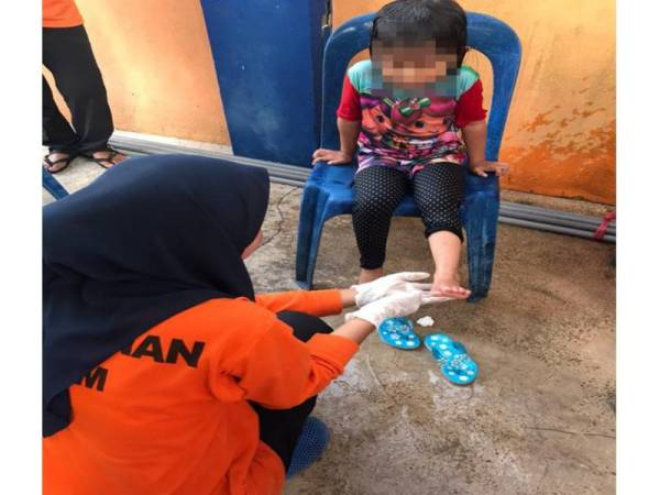 Seorang anggota APM Besut merawat kanak-kanak yang terkena gigitan obor-obor. Foto APM Besut