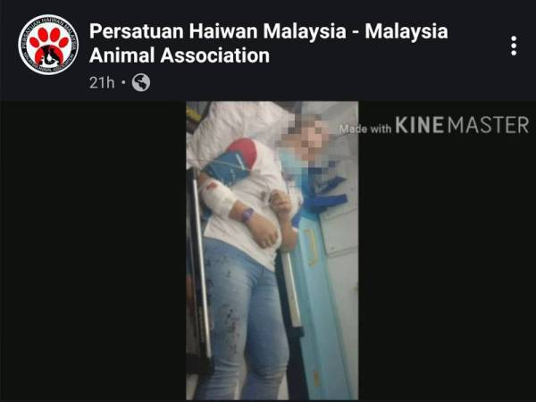 Mangsa mengalami kecederaan di tangan dan kaki selepas diserang seekor anjing.