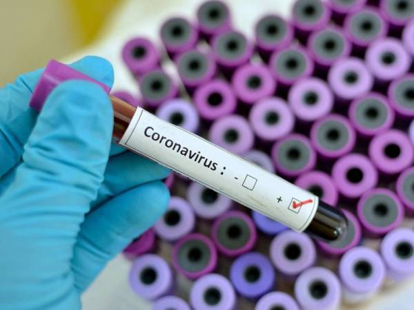 13 kes baharu koronavirus (Covid-19) direkodkan hari ini menjadikan jumlah kumulatif kes sebanyak 9,083 kes.