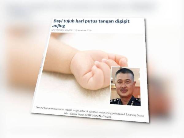 Dalam laporan Sinar Harian semalam, seorang bayi perempuan berusia tujuh hari putus tangan kanan akibat digigit seekor anjing peliharaan dalam kejadian kira-kira jam 10 pagi di rumahnya di Bachang di sini pada Selasa lalu.