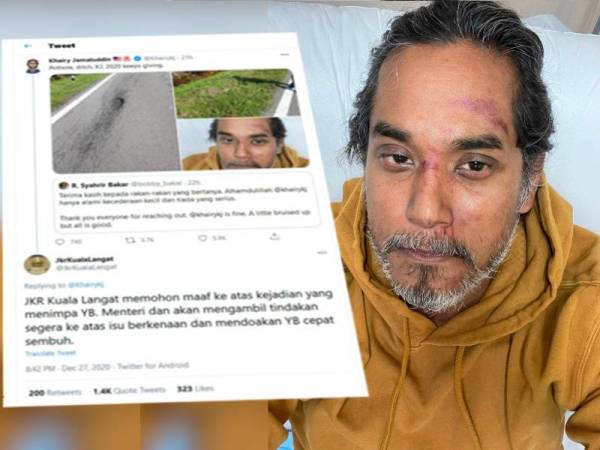 Foto Khairy yang dimuat naik di laman Twitter selepas mengalami kecederaan dalam kejadian pada Ahad.