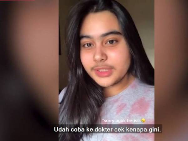 Nisya dari Jakarta yang mempunyai misai dan janggut curi tumpuan warga maya. - Foto Detiknews