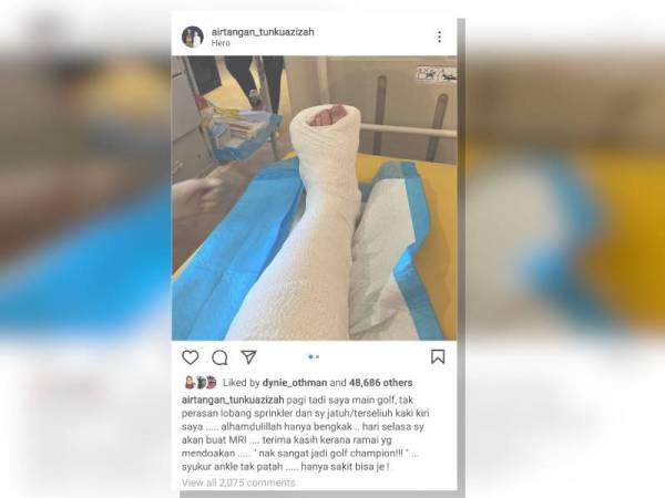 Seri Paduka Baginda memuat naik gambar kaki kirinya yang berbalut selepas menerima rawatan di laman Instagram.