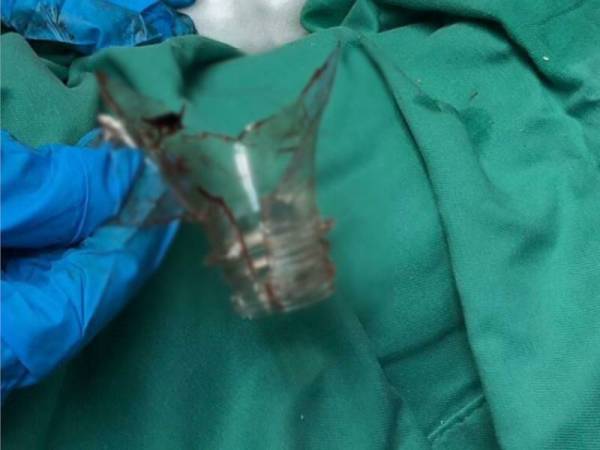 Botol plastik yang dipotong oleh anggota bomba di Hospital Pontian dalam kejadian pada Ahad.