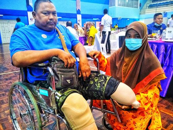 Rohimi kini terpaksa bergantung kepada isterinya, Normadiah menunjukkan kaki kudung bahagian kiri yang memerlukan kaki palsu.