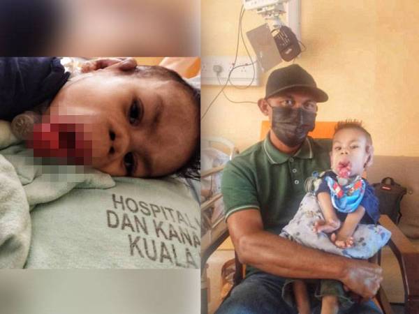 Kisah penderitaan Muhammad Aqil Aqmar Nordin,4 yang mengalami ketumbuhan di mulut turut tular di laman sosial. Nordin bersama Muhammad Aqil yang kini menunjukkan perkembangan positif sehingga kini selepas menjalani pembedahan tersebut.