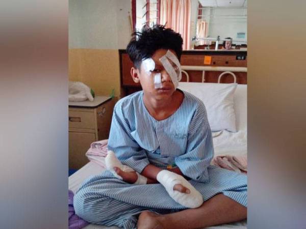 Mohd Adam Hakimi ketika menerima rawatan di Hospital Sultanah Nur Zahirah (HSNZ) Kuala Terengganu. - Foto Ihsan Mohd Riduan