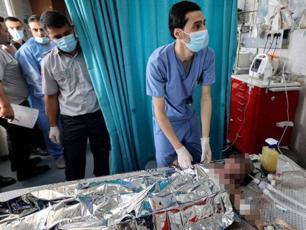 Seorang kanak-kanak cedera akibat serangan udara Tentera Israel dirawat di sebuah hospital di bandar Gaza pada Selasa lalu. - Foto AFP