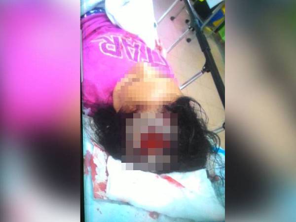 Kepala seorang wanita cedera parah digigit lotong dalam kejadian 21 Januari lalu. Foto: Perhilitan