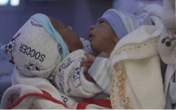 Bayi kembar Mohammed (kanan) dan Ahmed berjaya dipisahkan dalam satu pembedahan di sebuah hospital di Amman, Jordan baru-baru ini. -Foto EPA-EFE