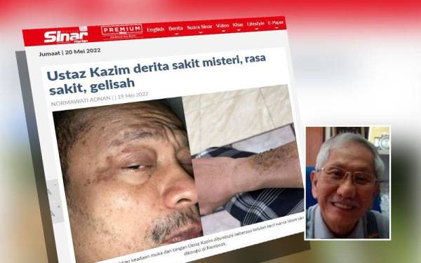 Ustaz Kazim berkongsi penderitaan dialami beliau sejak lapan bulan lalu yang menyebabkan luka di seluruh badan termasuk muka. Gambar kecil: Dr Low Bin Tick