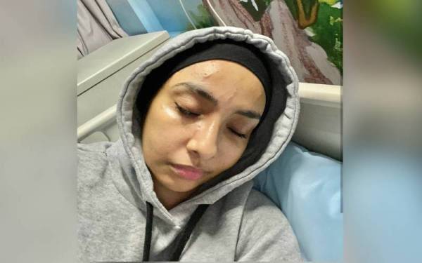 Lufya cedera di muka selepas bergelut dengan lelaki yang didakwa cuba menculik anaknya di taman permainan di Kota Damansara, Petaling Jaya, Ahad lalu. - Foto Instagram Lufyalaana
