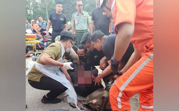 Tangan kiri mangsa hancur dan hampir putus selepas tersangkut pada rim motosikal diboncengnya di hadapan Hospital Tentera Darat Gemas, Tampin pada Selasa. Foto: Ihsan pembaca