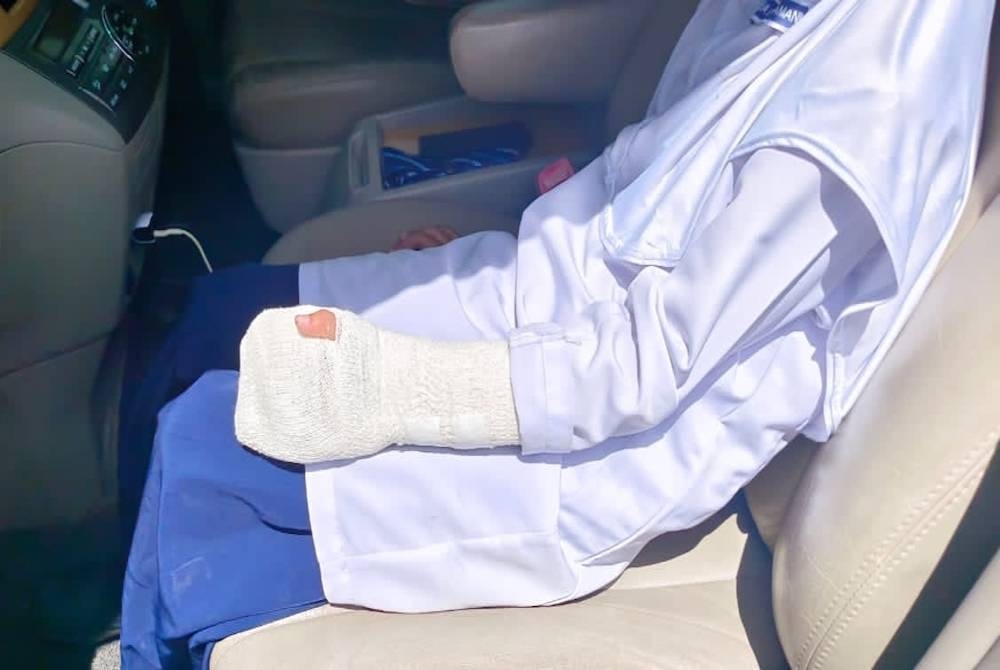 Perkongsian Mohd berhubung keadaan tulang jari kiri tangan anaknya yang patah dan terpaksa disimen akibat terkena kipas uzur yang terjatuh dari siling bilik darjah pada Selasa.