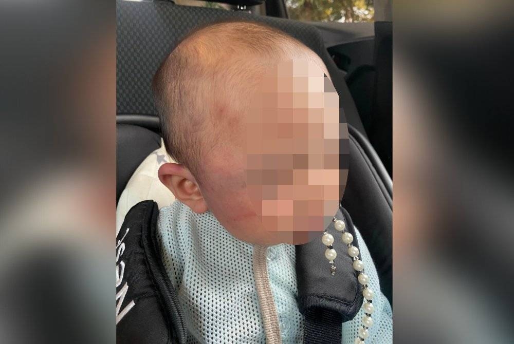 Gambar tular yang mendakwa seorang bayi menjadi mangsa penderaan di rumah pengasuh.