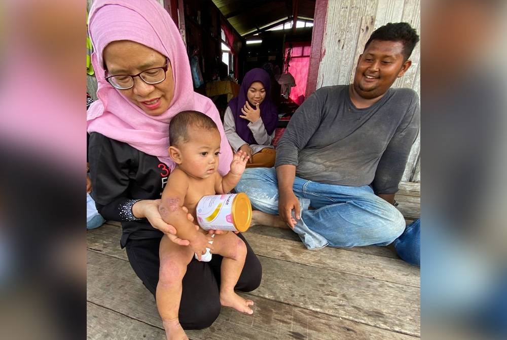 Wan Zalilah (kiri) menunjukkan keadaan penyakit kulit yang dialami oleh anak kepada pasangan Muhammad Khairiel dan Norhaslina.