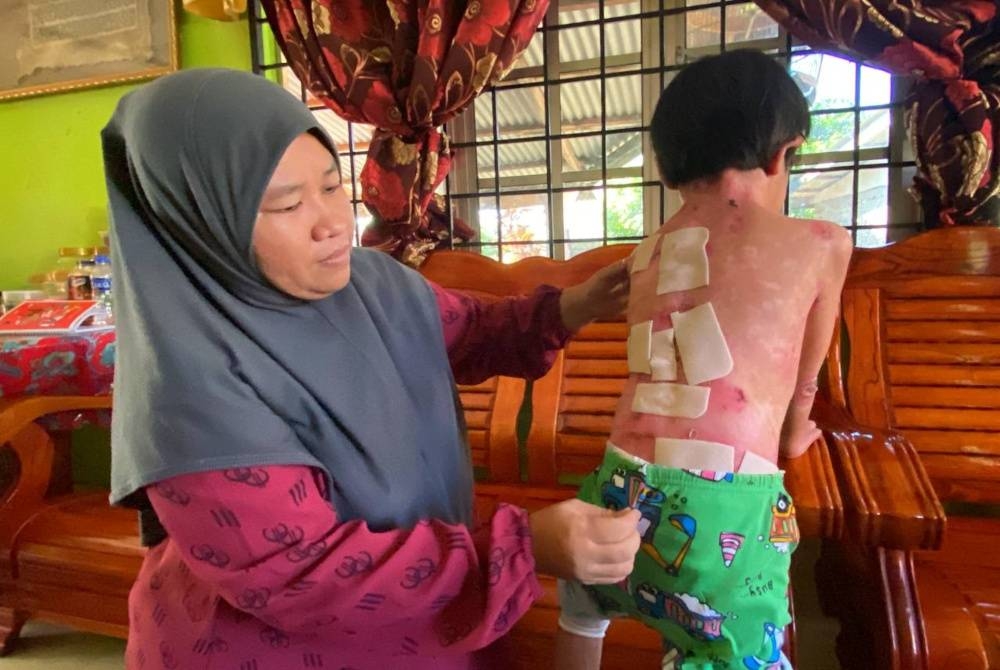 Muhammad Faris menderita penyakit kulit rapuh atau Epidermolysis Bullosa malu ke sekolah selepas terpaksa memakai lampin pakai buang sepanjang masa.