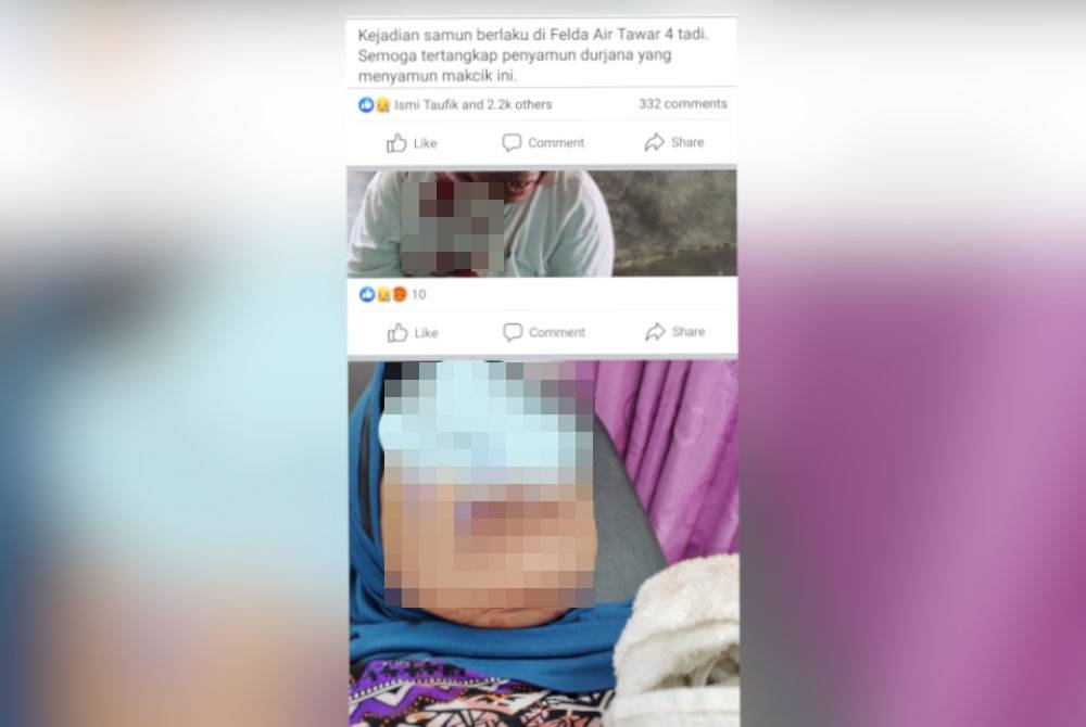 Tular gambar mangsa kejadian samun di Felda Air Tawar 4 Kota Tinggi pada Ahad.