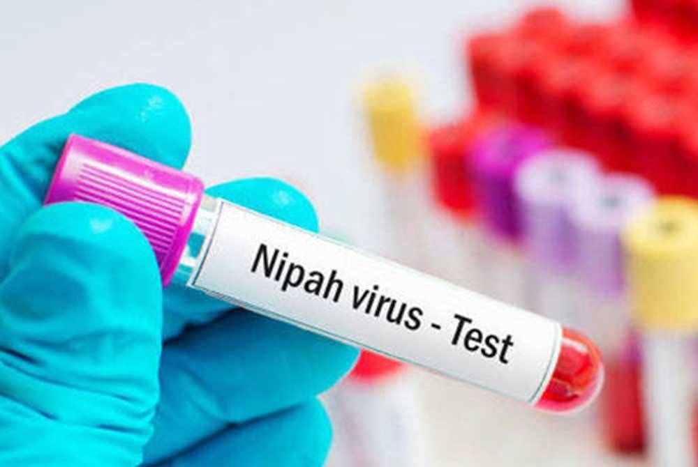 Virus Nipah dikesan menular di Kerala, India. - Agensi