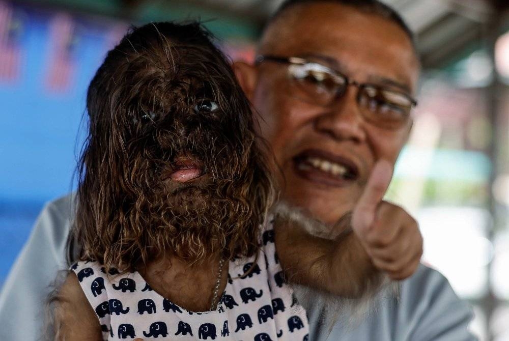 Missclyen Roland, dua tahun, dilahirkan dengan wajah dan tubuh berbulu lebat akibat sindrom congenital generalised hypertrichosis (CGH) ketika ditemui di Kampung Penan Muslim Batu 10, Bintulu - Miri, pada Khamis. - Foto Bernama