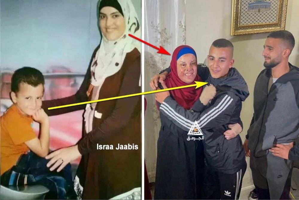 Gambar Israa Jaabis dan anak lelakinya sebelum kemalangan dan selepas pembebasannya dari penjara Israel.